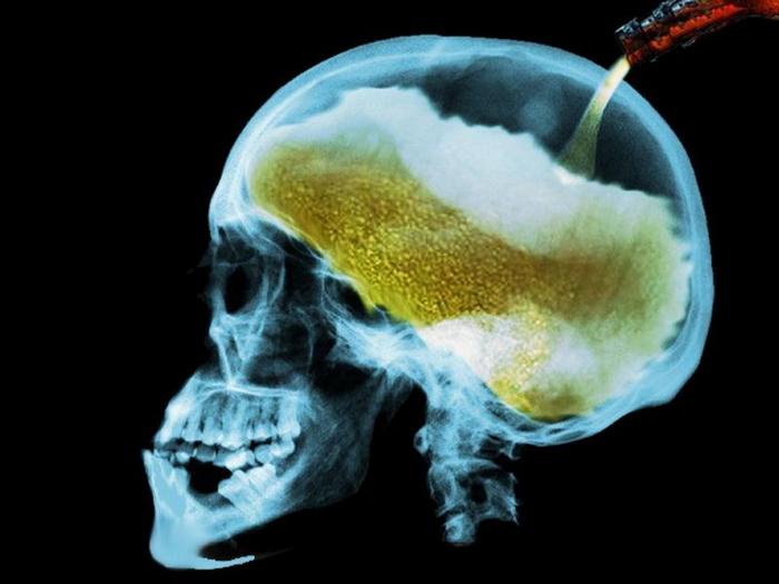 Влияние алкоголя на головной мозг
